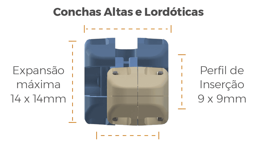 Concha Alta